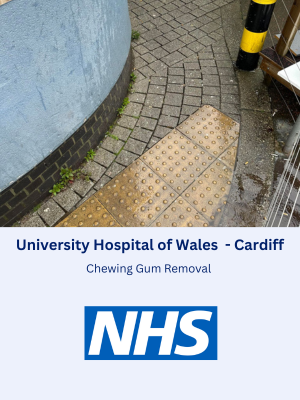 Chewing Gum Removal at University Hospital of Wales in Cardiff, Wales
